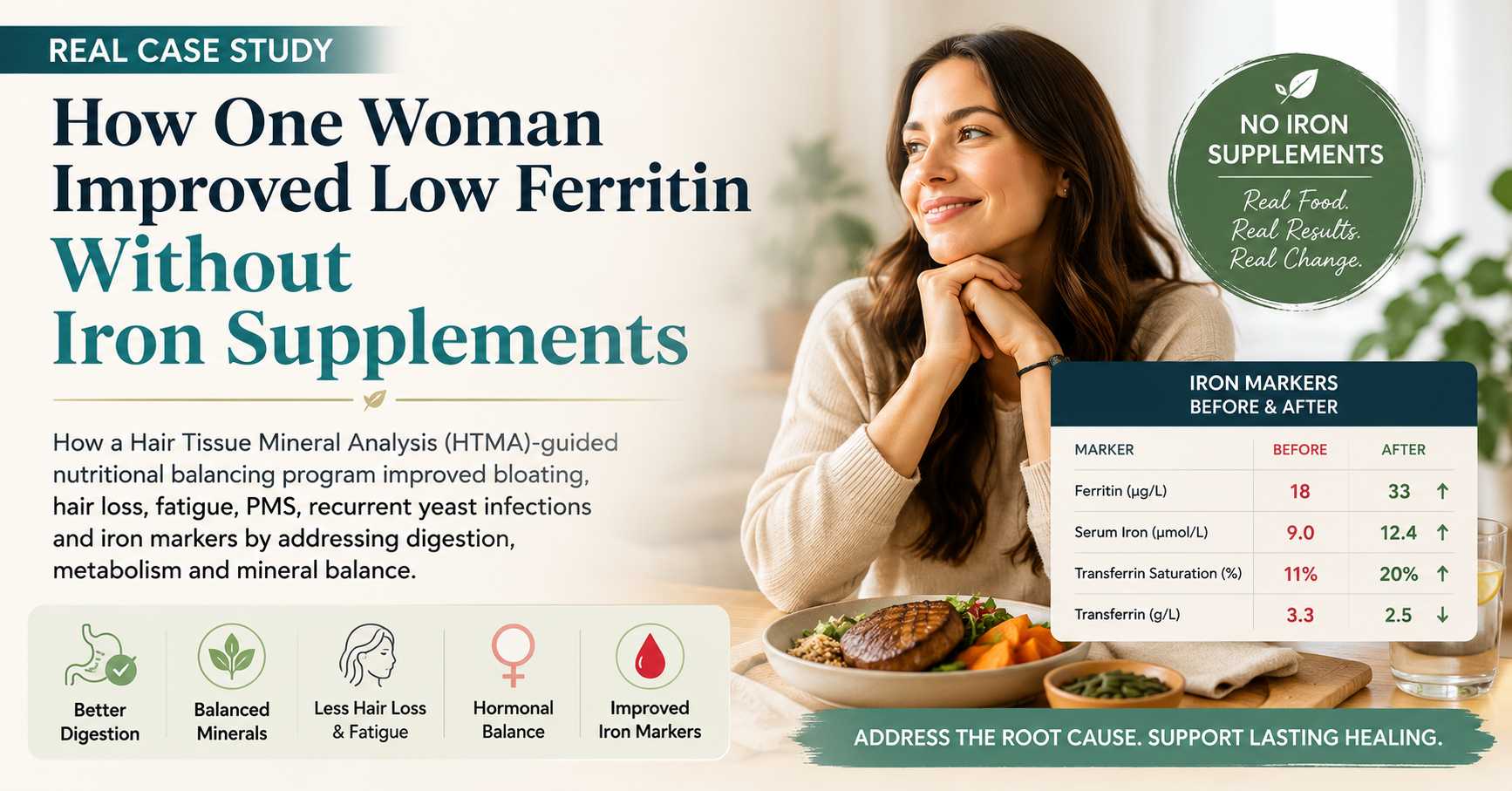 Cover image for a real case study showing how a Hair Tissue Mineral Analysis (HTMA)-guided nutritional balancing program improved low ferritin, bloating, fatigue, hair loss, PMS, and iron markers without iron supplements.