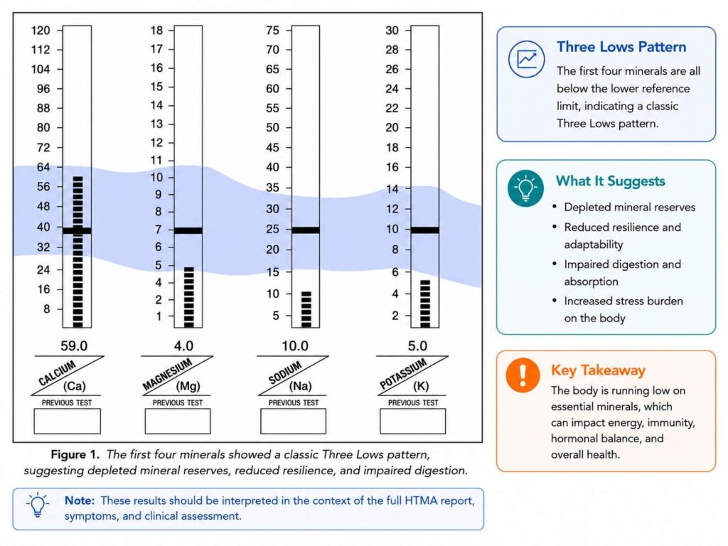 Three Lows pattern on a Hair Tissue Mineral Analysis (HTMA) report showing low calcium, magnesium, sodium, and potassium levels, suggesting depleted mineral reserves, reduced resilience, impaired digestion, and increased stress burden.
