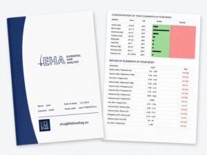 Elemental Hair Analysis (EHA) sample report showing the Lifeline Diagnostics report cover beside a hair mineral analysis results page with toxic element concentrations and mineral ratio analysis.